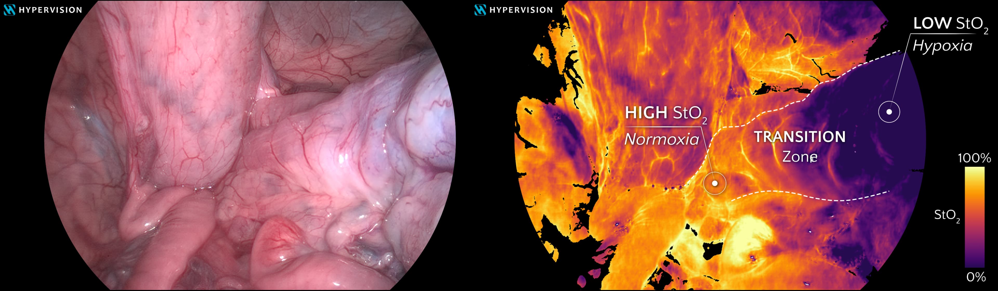 onventional colour imagery and real-time quantitative tissue oxygenation maps