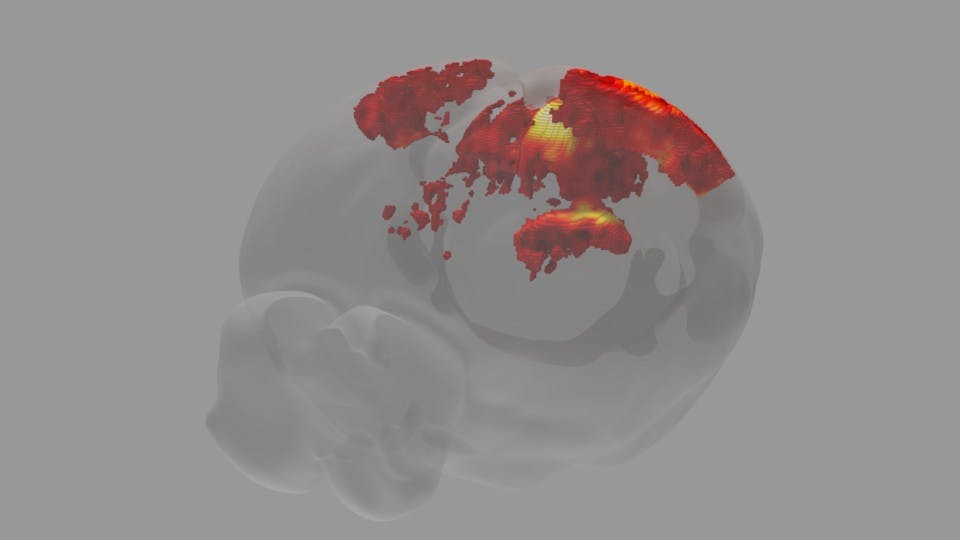 3D Brain Visual