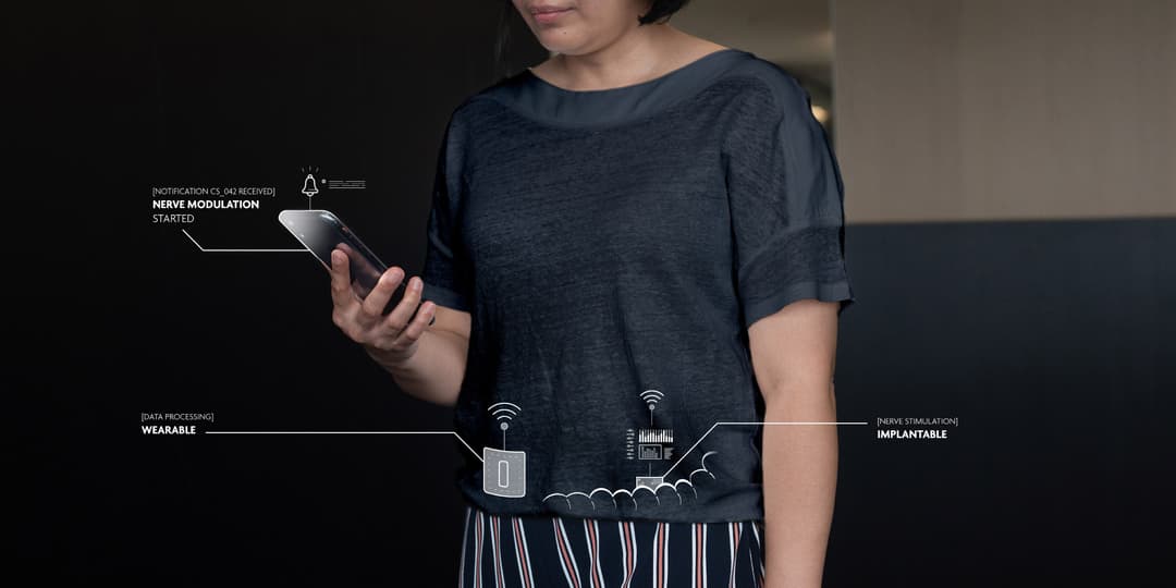 Ingestible sensors for diagnostics and prevention | imec