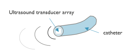 Catheter