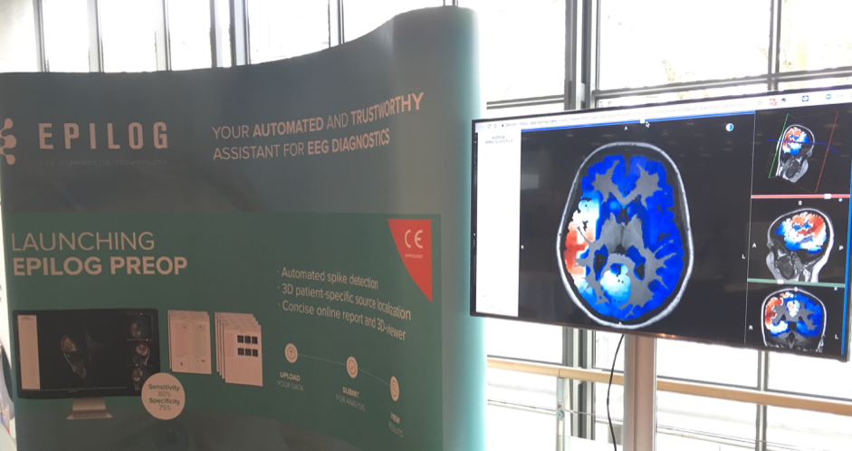Epilog lanceert Epilog PreOp, een geautomatiseerde tool voor pre-operatieve EEG analyse