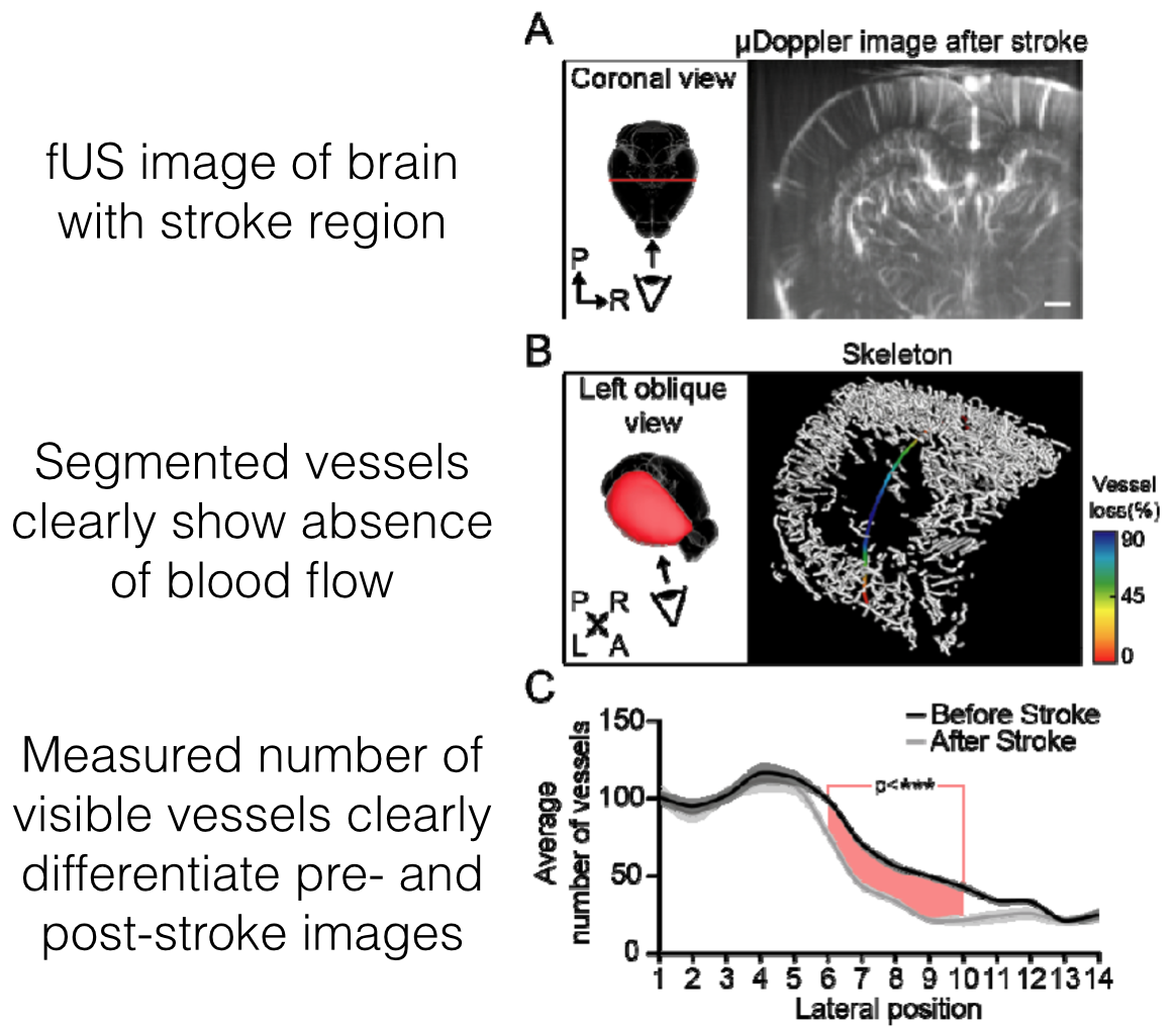 AI-based Image Analysis and Registration for Functional Ultrasound based Brain Activation Detection and Mapping