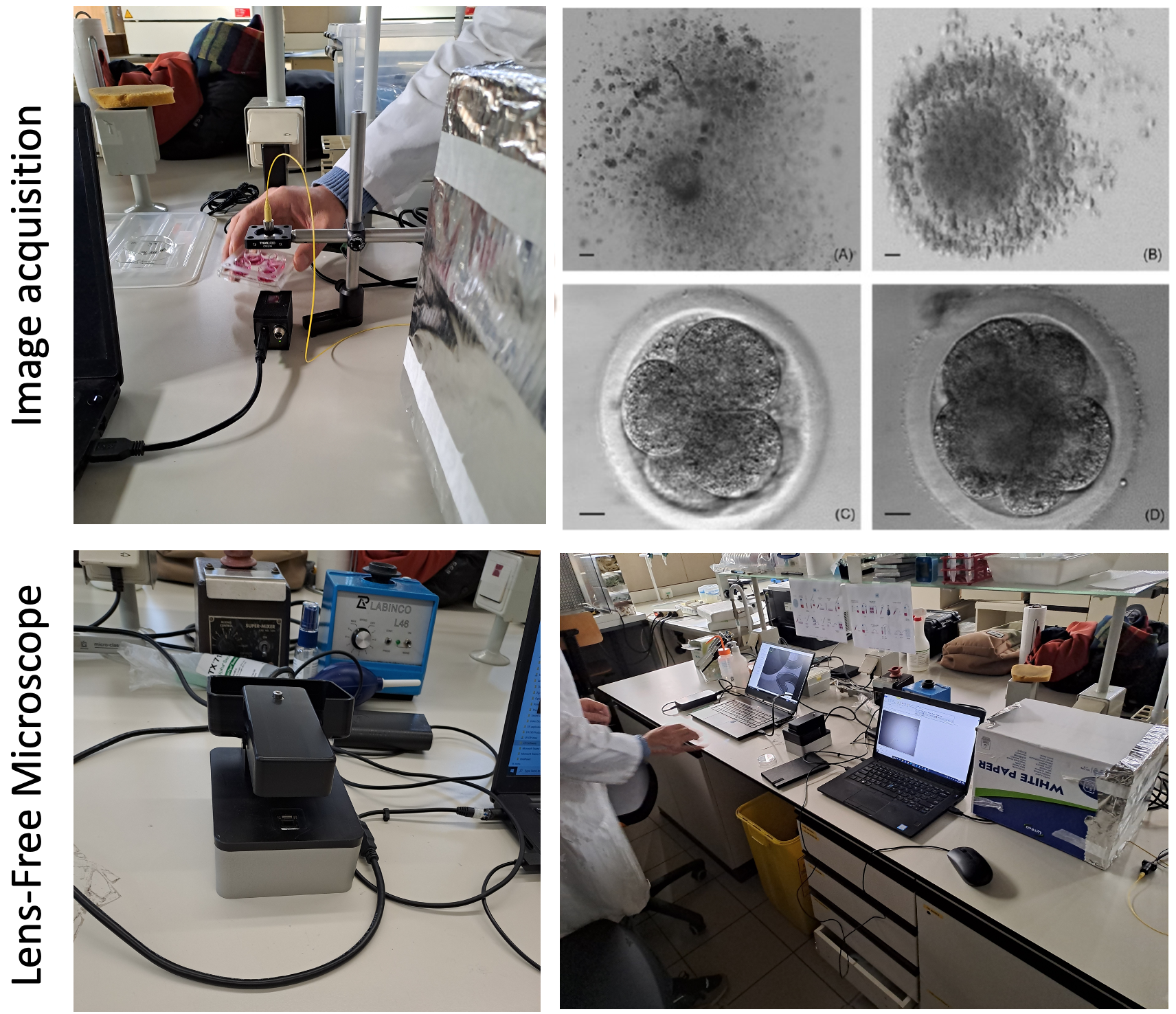 LFI for IVF