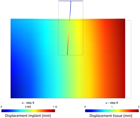 Measurement of forces