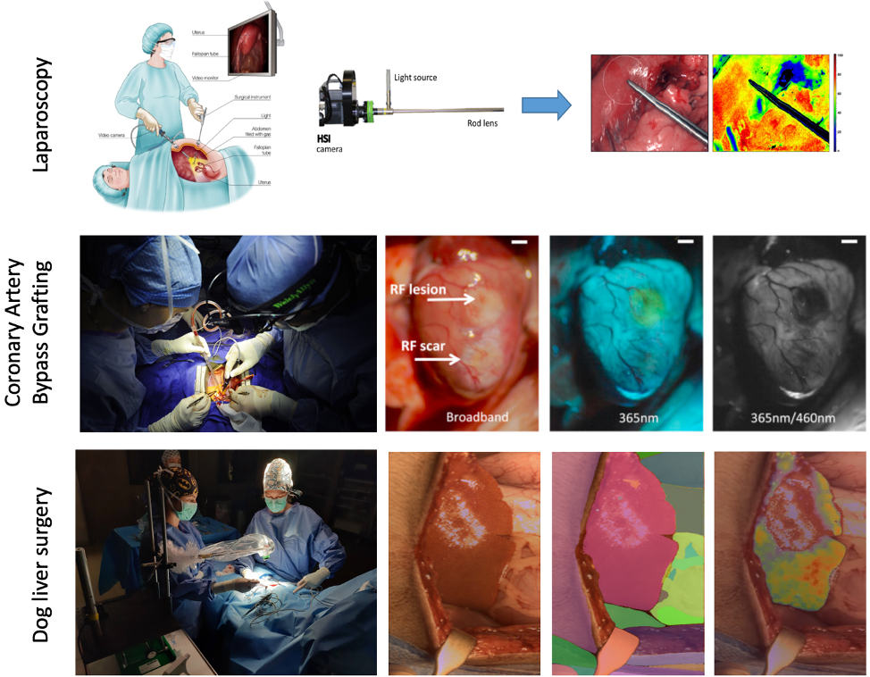 Surgical HSI